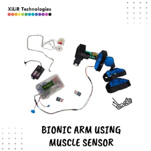 Bionic Arm Using Arduino with EMG Sensor – Smart Prosthetic Hand Project