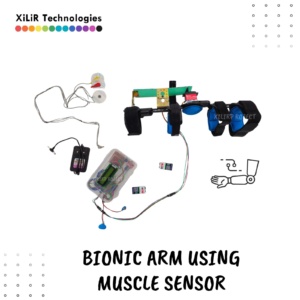 emg sensor module project, servo based robotic hand, arduino uno hand project, prosthetic hand servo motor, wearable robotic hand design, arduino bionic limb with sensor, robotic hand with mechanical elbow, arduino with myoware sensor, 3d printed robotic arm with emg, prosthetic arm arduino code
