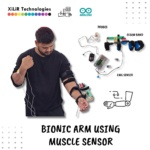Prosthetic Arm Using Muscle Sensor Arduino Project