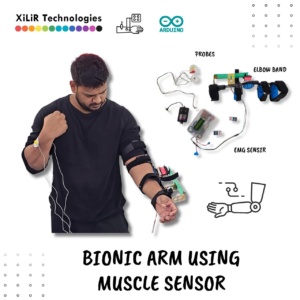 Prosthetic Arm Using Muscle Sensor Arduino Project