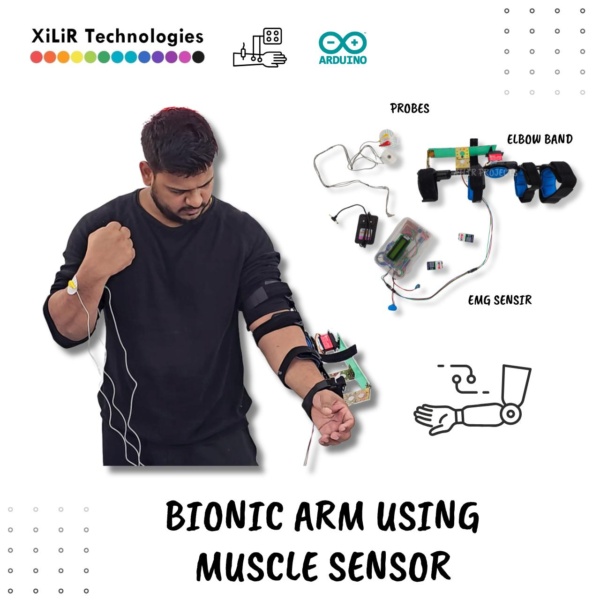 Prosthetic Arm using Arduino and Muscle Sesnor Prosthetic Arm Using Muscle Sensor Arduino Project